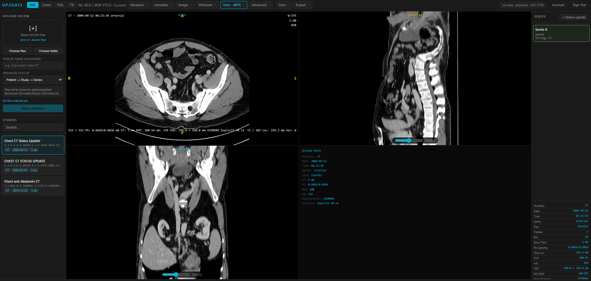Ejemplo del visor DIVE mostrando un estudio CT en vistas axial, coronal y sagital
